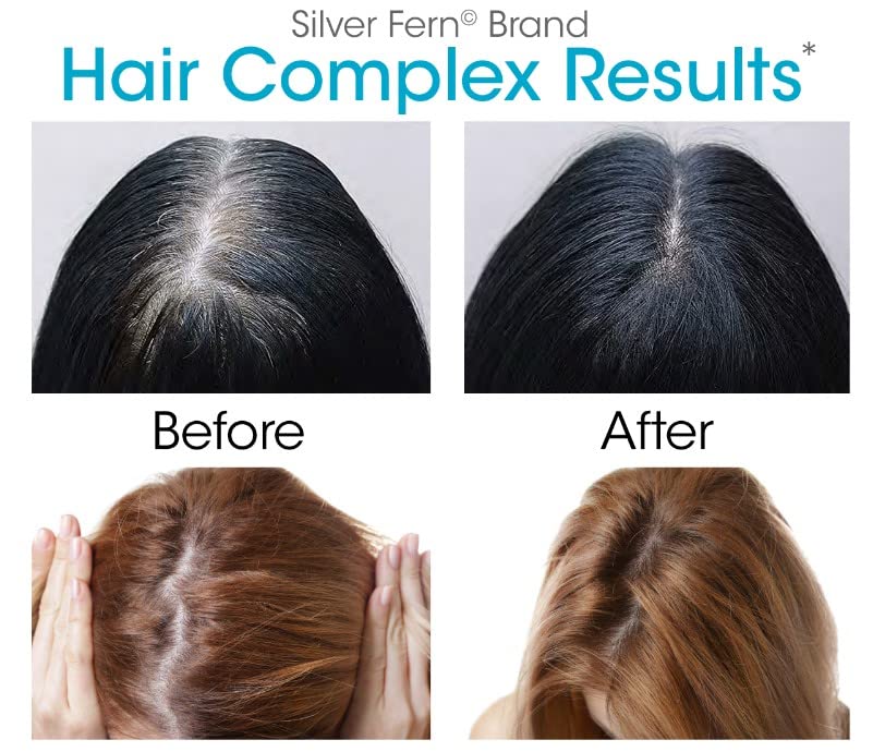 Silver Fern Hair Complex - Hair Supplement for Promoting Healthy Hair | Each Bottle Contains a 30-Day Powder Supply - 1 Bottle