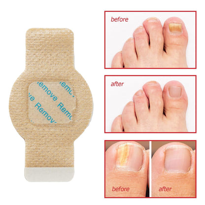 42pcs Toenail Care Patches for Dry, Weak & Cracked Nails, Deeply Moisturizing Nail Surface