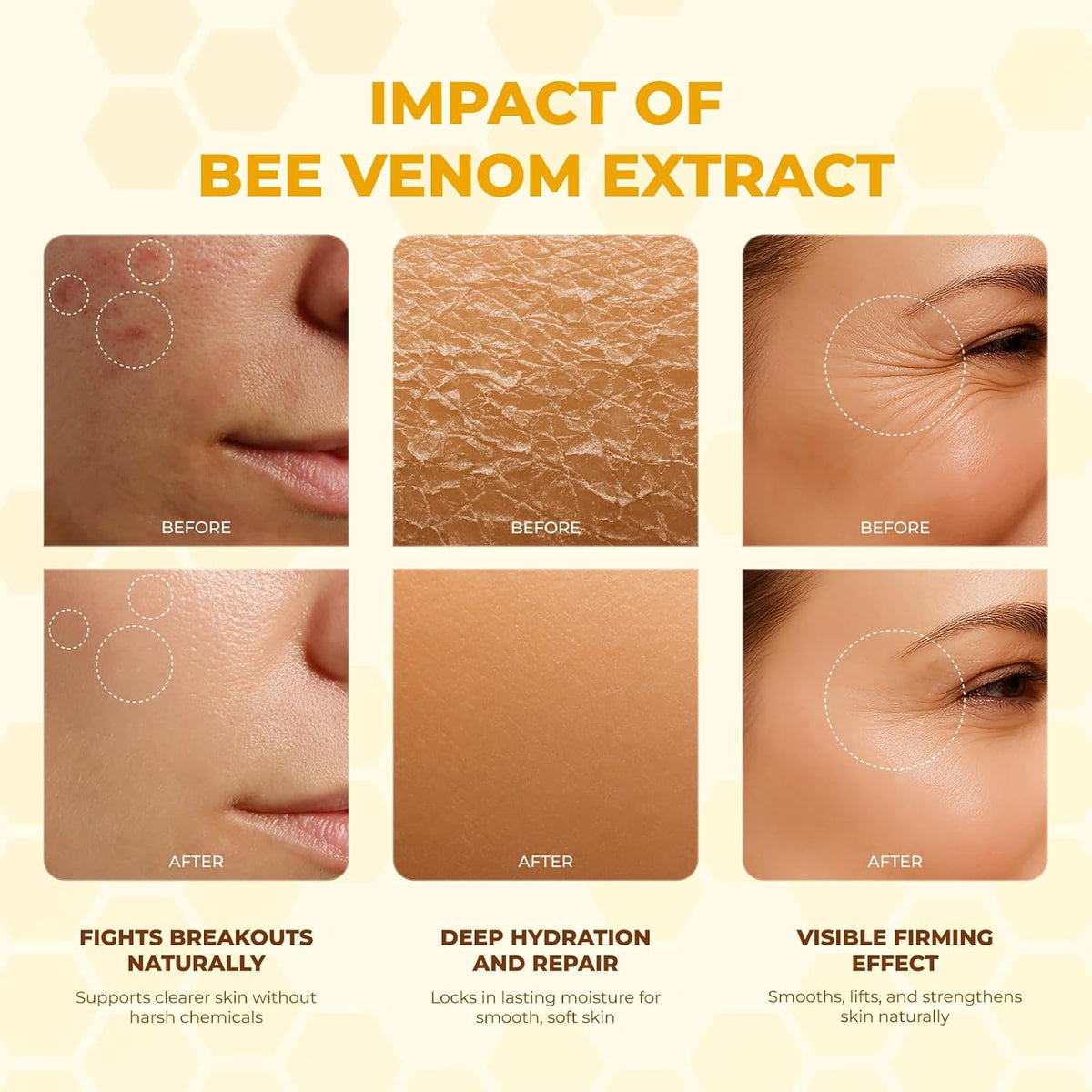 MONIER Bee Venom Cream | Hydrating, Smoothing, Firming, Wrinkle-Reducing | Comprehensive Bee Venom Skin Treatment Cream (Enhanced Formula)