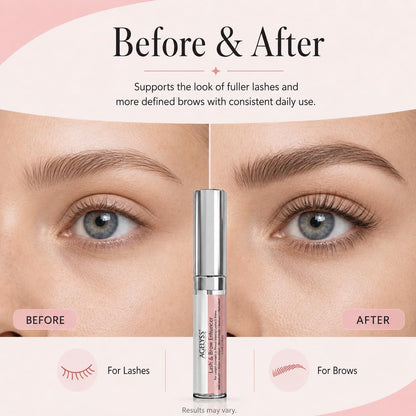 Agelyss Lash & Brow Enhancer - Longer, Stronger & Thicker Lash and Brows - 1 Bottle