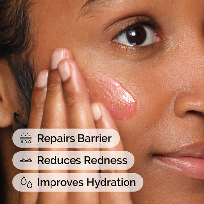 The Ordinary Soothing & Barrier Support Serum, Redness-Reducing & Hydrating Solution for Skin Barrier Recovery, 1 Fl Oz