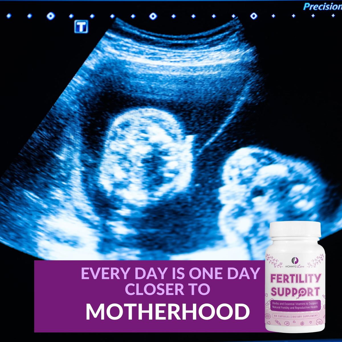Myo-Inositol Conception Fertility Prenatal Vitamins for Healthy Ovarian Function plus Apple Cider