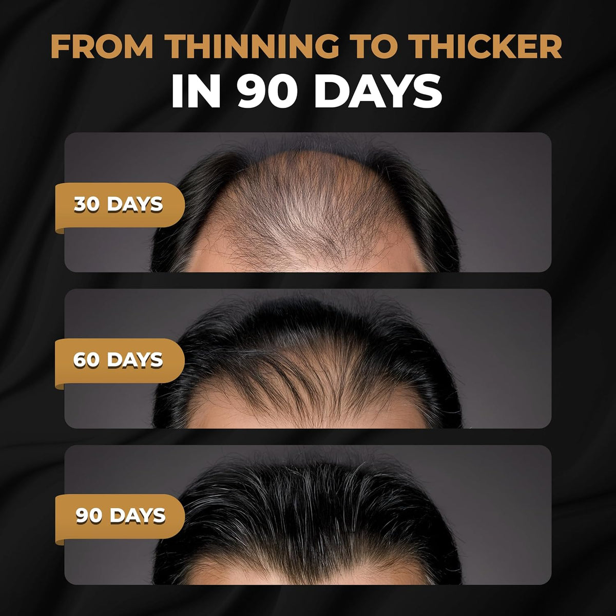 SPARTAN™ Root Activator Shampoo For Men - Hair Growth Shampoo for Hair Loss and Thinning Hair