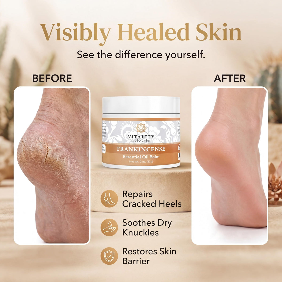 Vitality Extracts Frankincense Balm - 2oz, Boswellia Serrata, Beeswax, Olive Oil, Moisturizer for Dry, Cracked Skin, All Skin Types