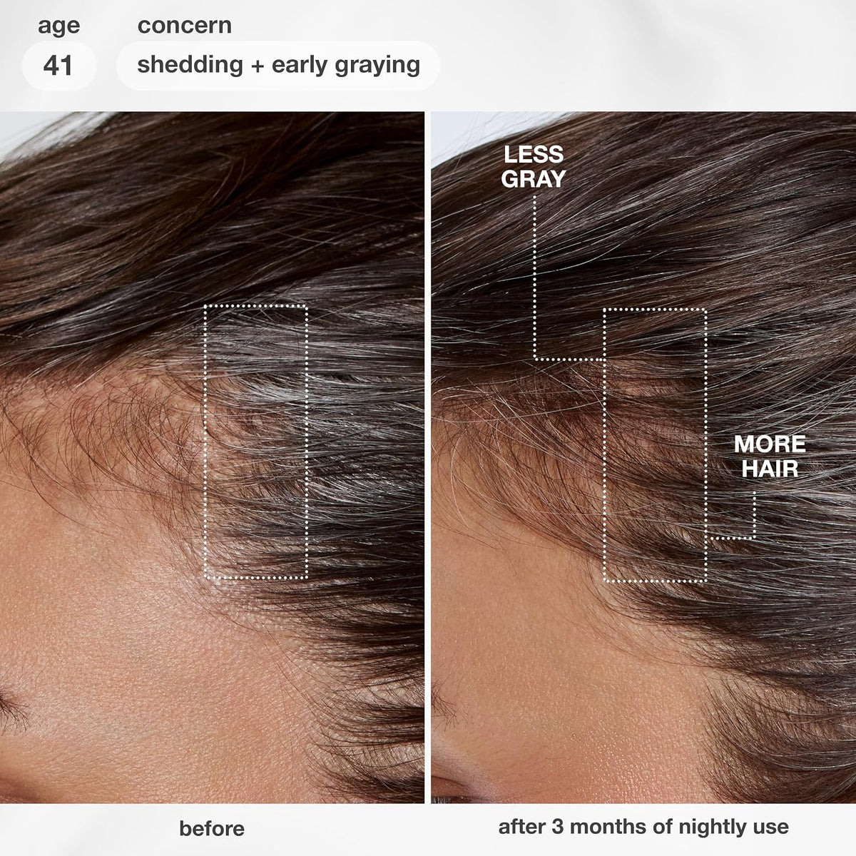 K18 FutureIQ Biomimetic Longevity Hair + Scalp Serum, 3.04 oz